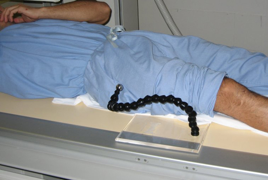 OrthoMark used in hip replacement surgery