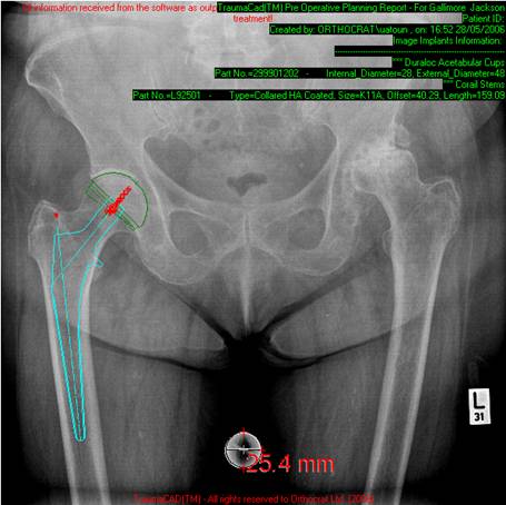PACS integration of orthopedic data